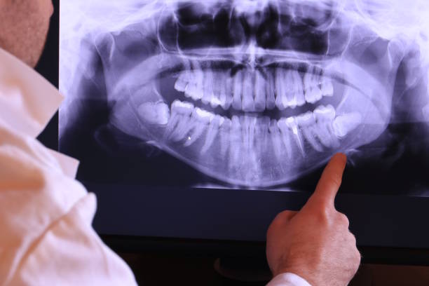 Best Emergency Tooth Extraction in Bayside, WI